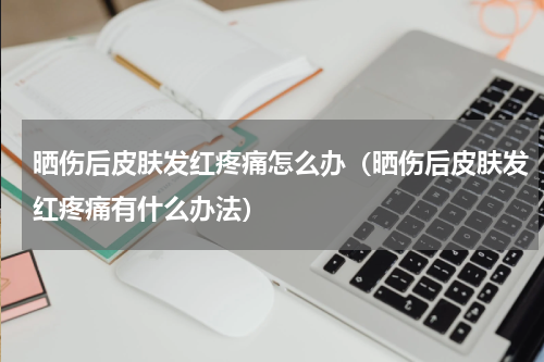 晒伤后皮肤发红疼痛怎么办（晒伤后皮肤发红疼痛有什么办法）