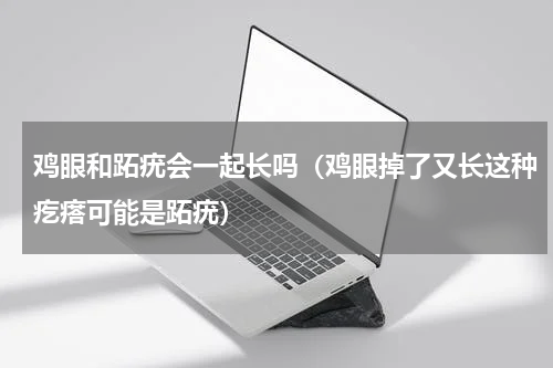 鸡眼和跖疣会一起长吗（鸡眼掉了又长这种疙瘩可能是跖疣）